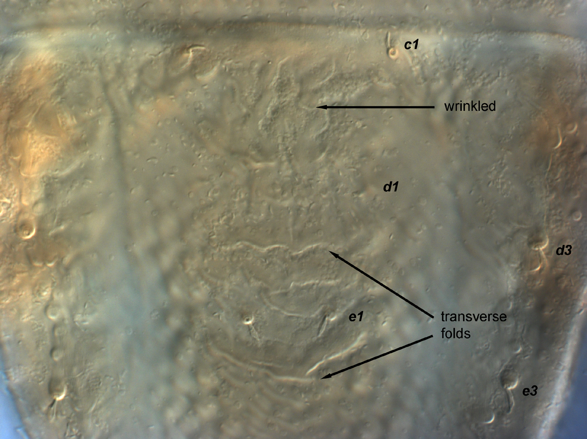  Fig. 5.  Brevipalpus phoenicis  sensu stricto, female anterior dorsal opisthosoma. 