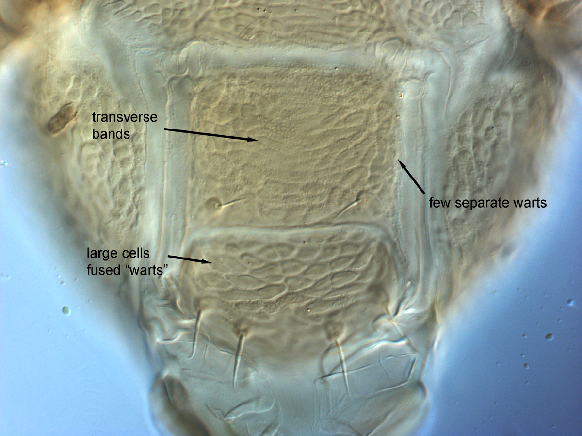  Fig. 15.  Brevipalpus phoenicis  sensu stricto, female posterior venter. 
