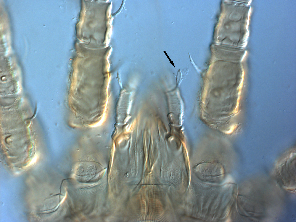  Fig. 10.  Brevipalpus phoenicis  sensu stricto, female dorsal seta on palp femurogenu (indicated by arrow). 