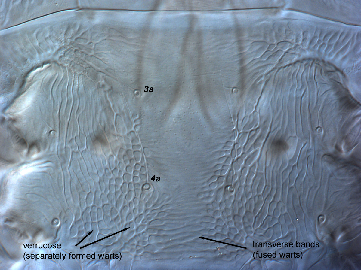  Fig. 12.  Brevipalpus phoenicis  sensu stricto, female venter, between coxae III-IV. 