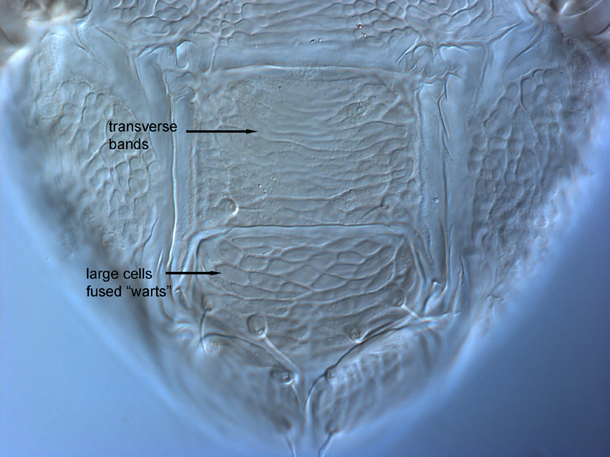  Fig. 14.  Brevipalpus phoenicis  sensu stricto, female posterior venter. 