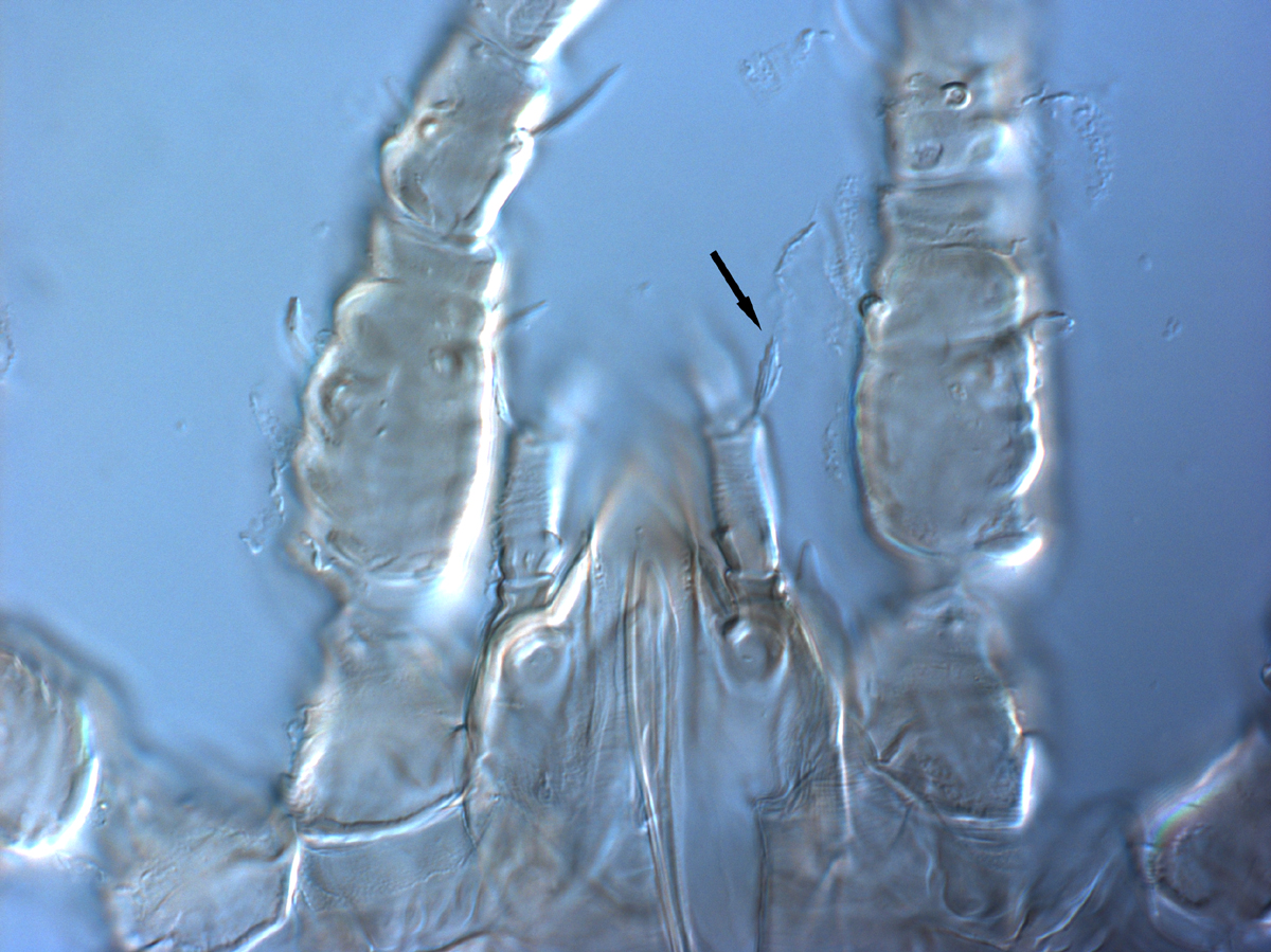  Fig. 11.  Brevipalpus phoenicis  sensu stricto, female dorsal seta on palp femurogenu (indicated by arrow). 