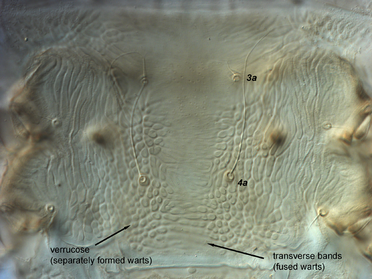  Fig. 13.  Brevipalpus phoenicis  sensu stricto, female venter, between coxae III-IV. 