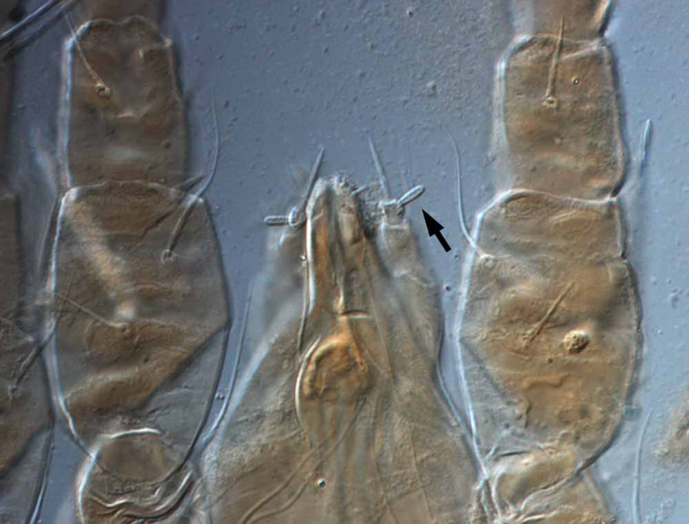            Fig. 12.   Brevipalpus portalis  female palp tarsus - arrow   indicates short solenidion (paratype).   