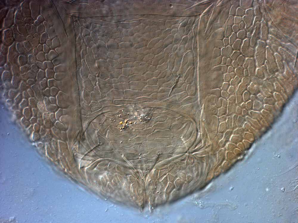            Fig. 9.   Brevipalpus portalis  female posterior venter   (paratype).   