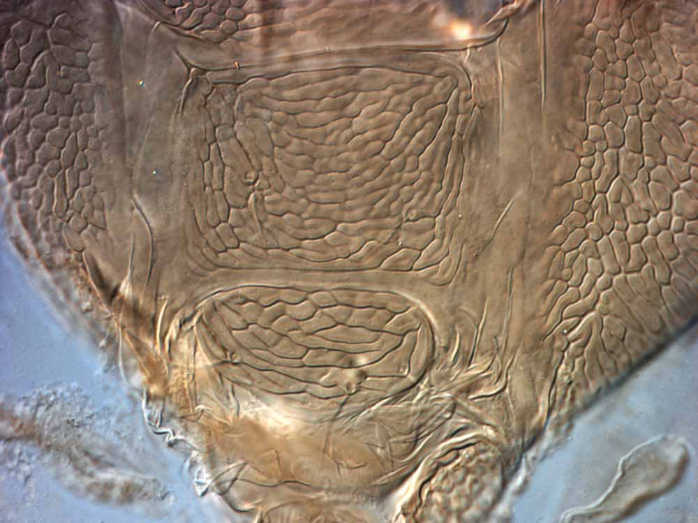            Fig. 10.   Brevipalpus portalis  female posterior   venter.   