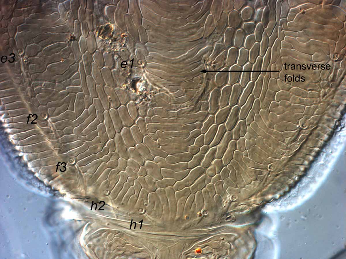            Fig. 7.   Brevipalpus portalis  female posterior   dorsum.   