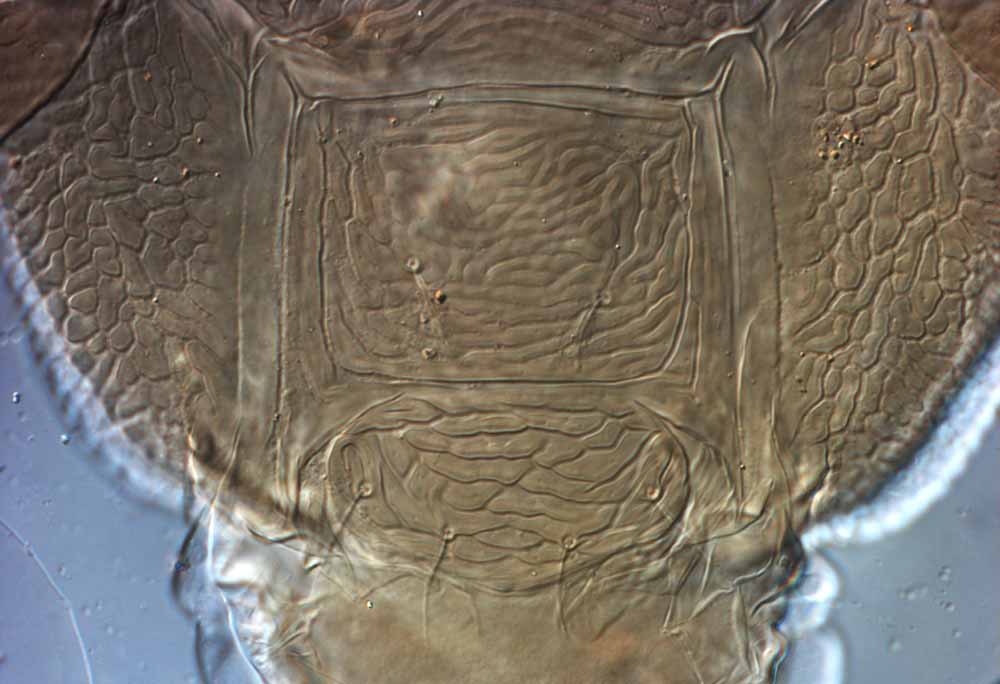            Fig. 11.   Brevipalpus portalis  female posterior   venter.   