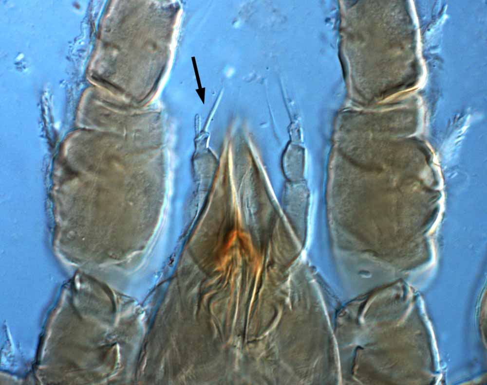            Fig. 13.   Brevipalpus portalis  female palp tarsus - arrow   indicates 2 distal setae.   