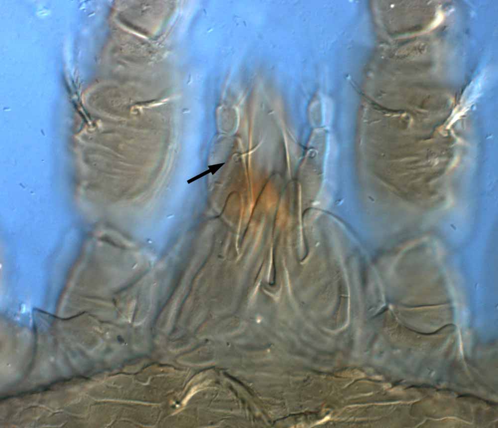            Fig. 14.   Brevipalpus portalis  female gnathosoma - arrow   indicates seta on palp femur.   