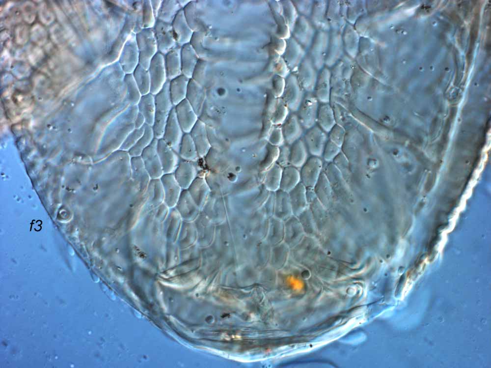           Fig. 7.   Brevipalpus recki  female posterior dorsum   (focused laterally).   