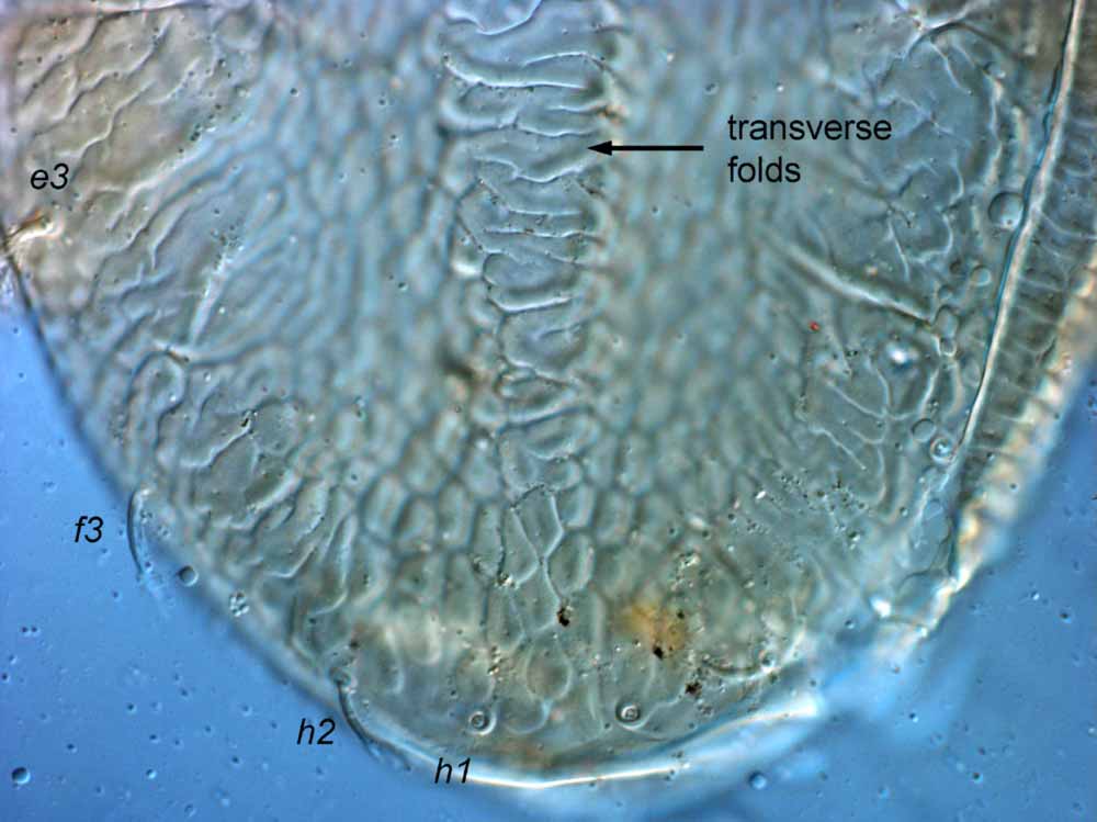            Fig. 6.   Brevipalpus recki  female posterior dorsum   (focused centrally).   