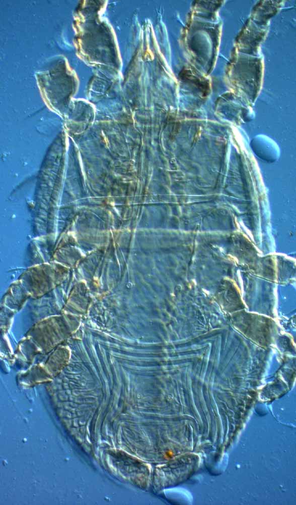            Fig. 9.   Brevipalpus recki  female venter.   