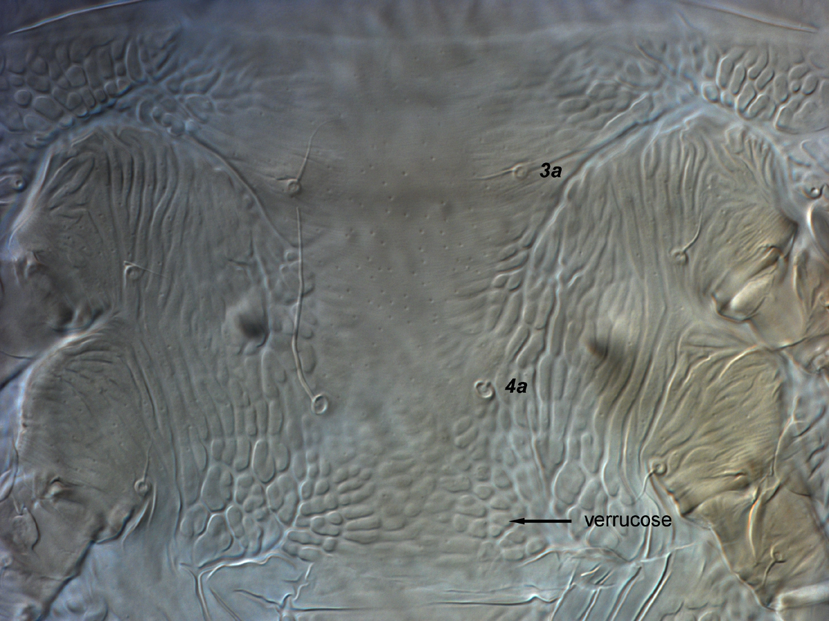 Fig. 14.  Brevipalpus yothersi , adult female venter, between coxae III-IV. 