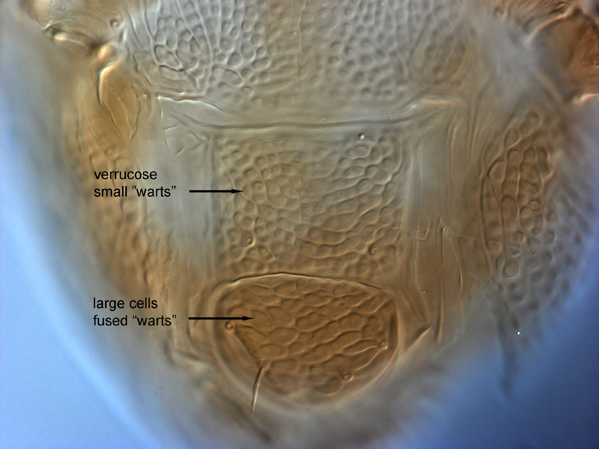  Fig. 16.  Brevipalpus yothersi , adult female posterior venter (paratype). 