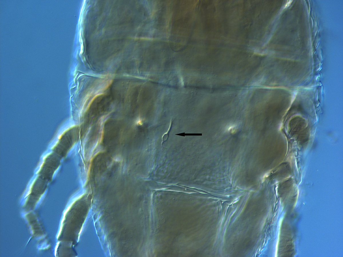  Fig. 18.  Brevipalpus yothersi , adult female spermatheca, indicated by arrow (paraytpe). 