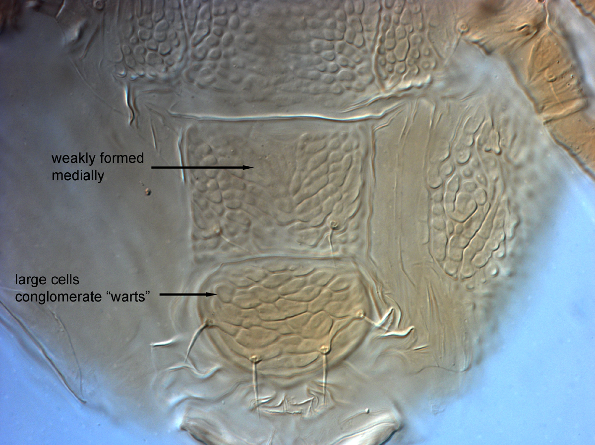  Fig. 17.  Brevipalpus yothersi , adult female posterior venter (paratype). 