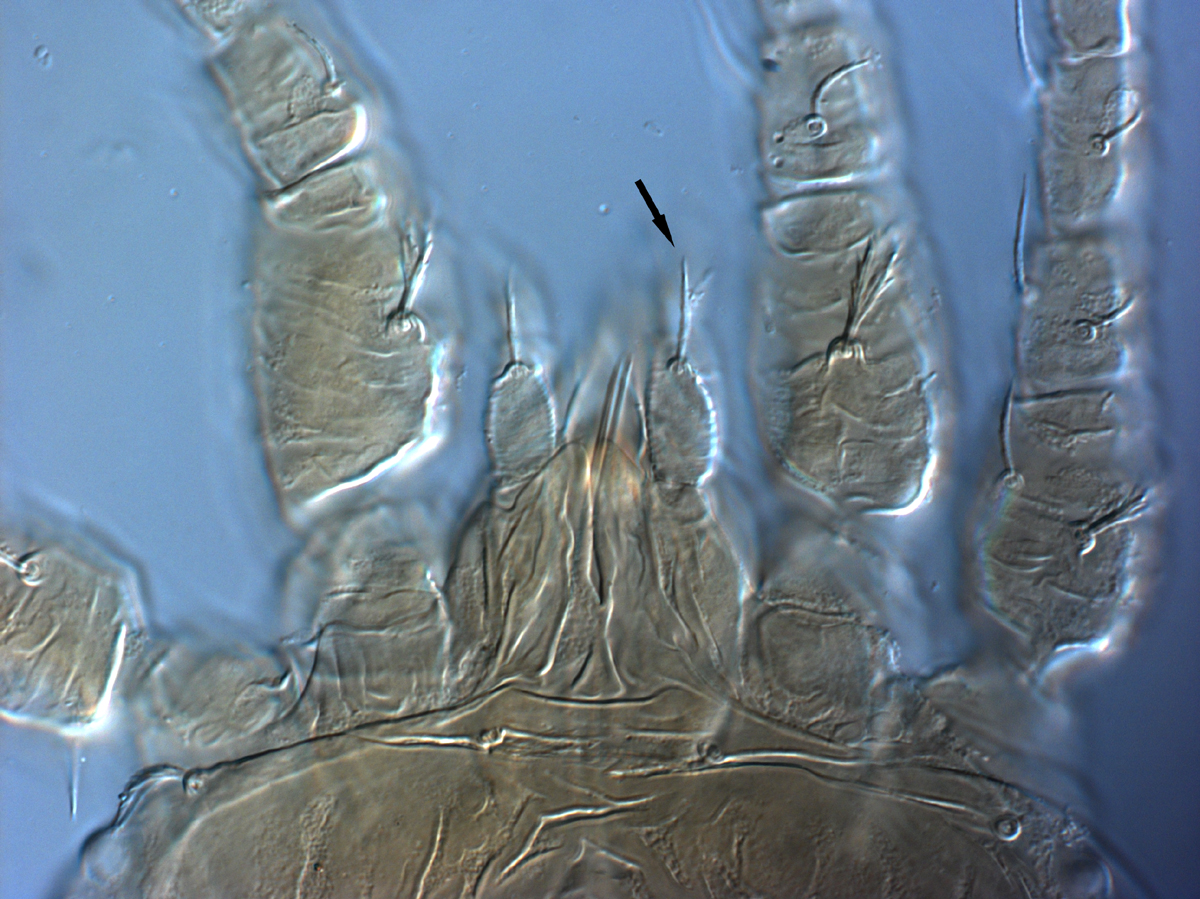  Fig. 11.  Brevipalpus yothersi , adult female dorsal seta on palp femurogenu (indicated by arrow) (paratype). 