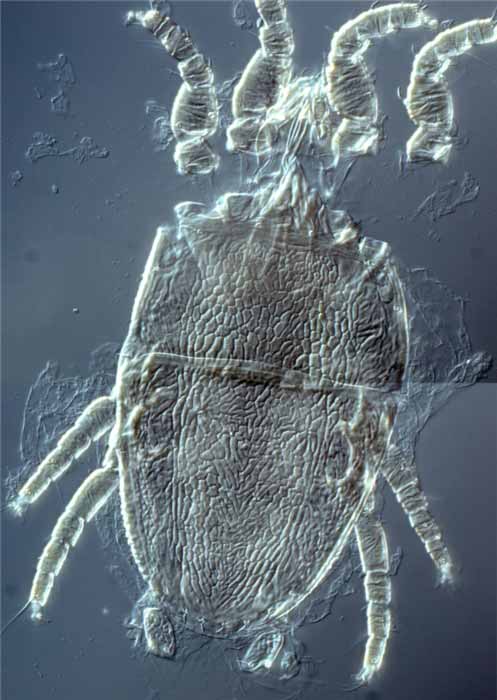            Fig. 5.   Brevipalpus  sp. female   dorsum.   