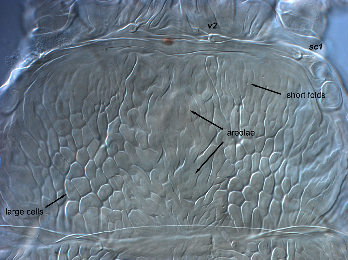  Fig. 5.  Brevipalpus tucuman , female prodorsum. 