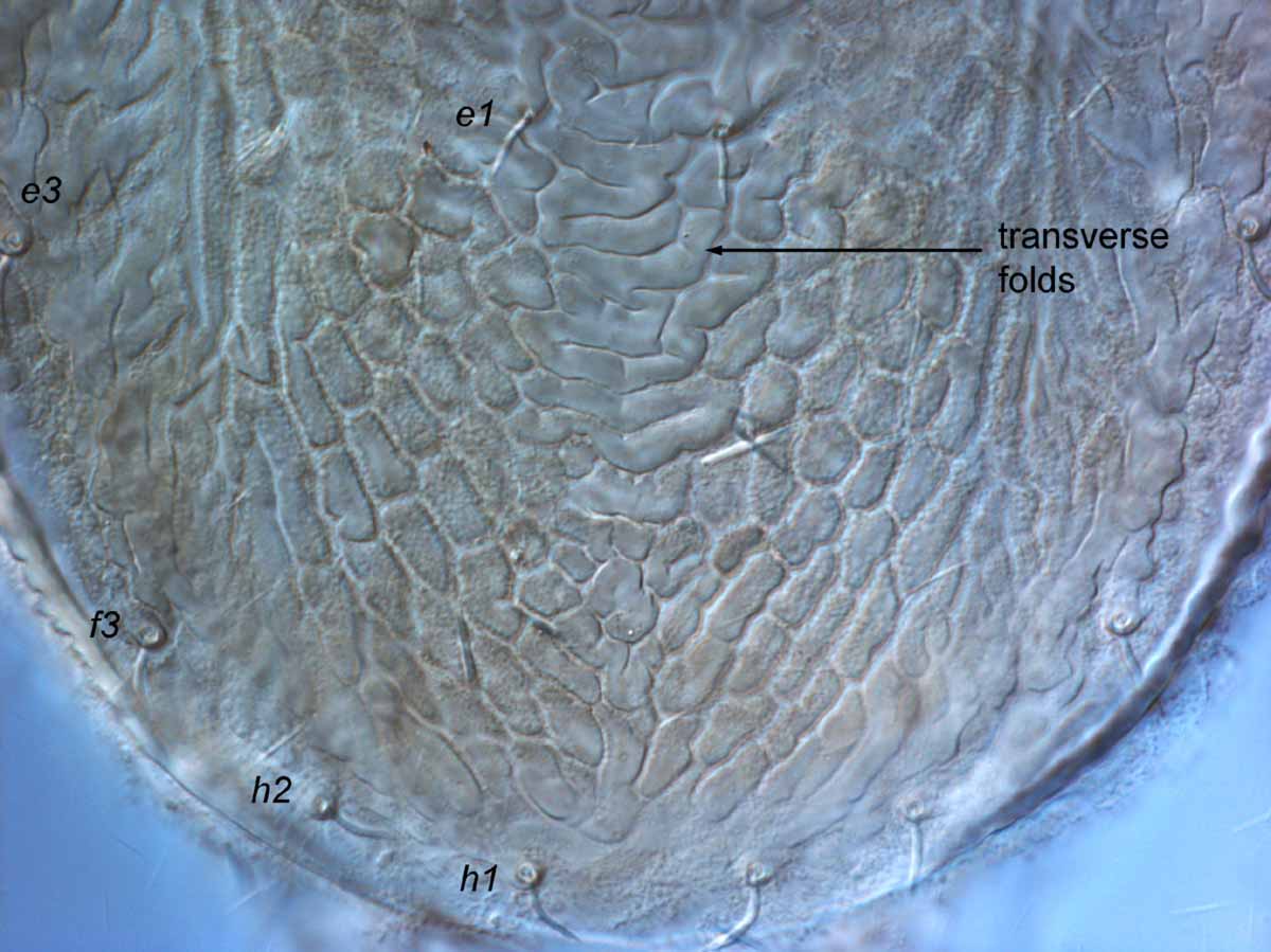            Fig. 10.   Brevipalpus chilensis  female posterior   dorsum.   