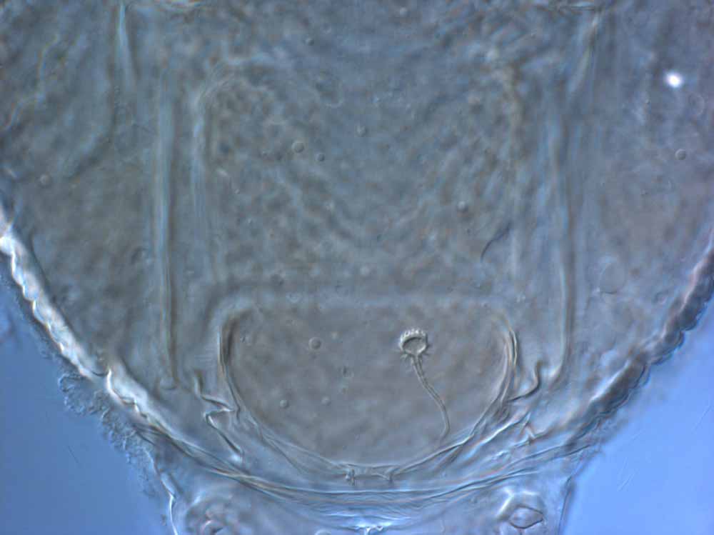            Fig. 15.   Brevipalpus chilensis  female   spermatheca.   
