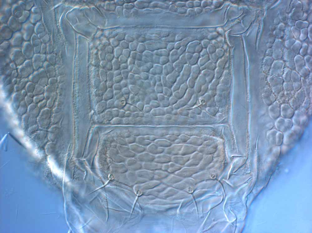            Fig. 13.   Brevipalpus chilensis  female posterior   venter.   