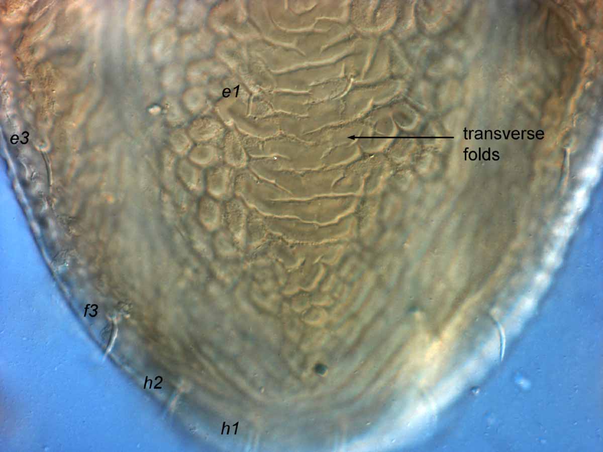            Fig. 11.   Brevipalpus chilensis  female posterior dorsum.      