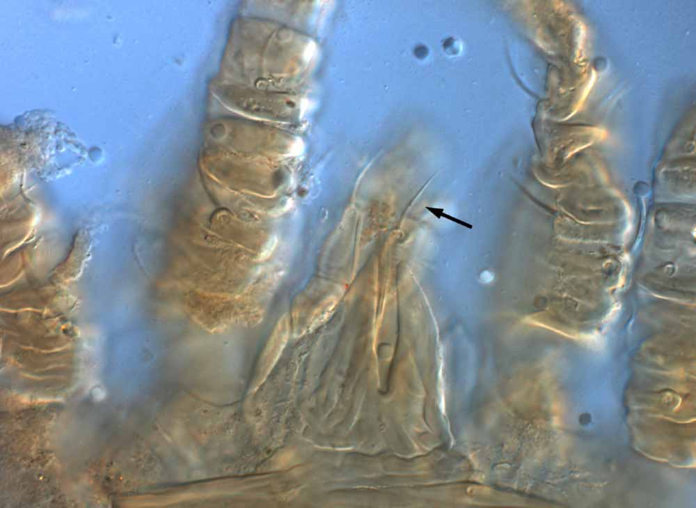            Fig. 17.   Brevipalpus chilensis  adult female gnathosoma with   arrow indicating dorsal seta on palp femur.   