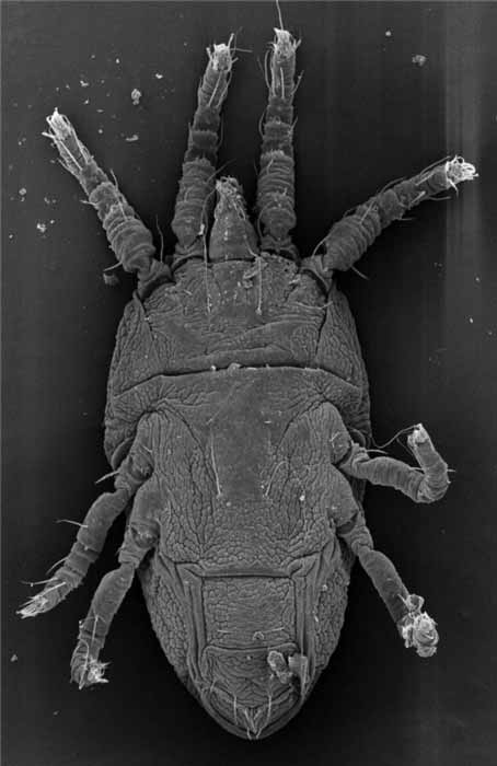            Fig. 8.   Brevipalpus chilensis  female venter   (image: Gary Bauchan, USDA-ARS).   