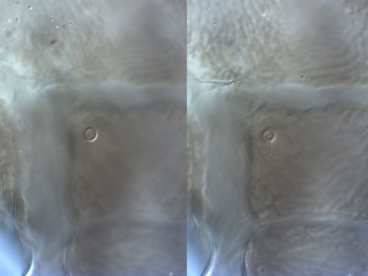  Fig. 18.  Brevipalpus feresi , female spermatheca. 