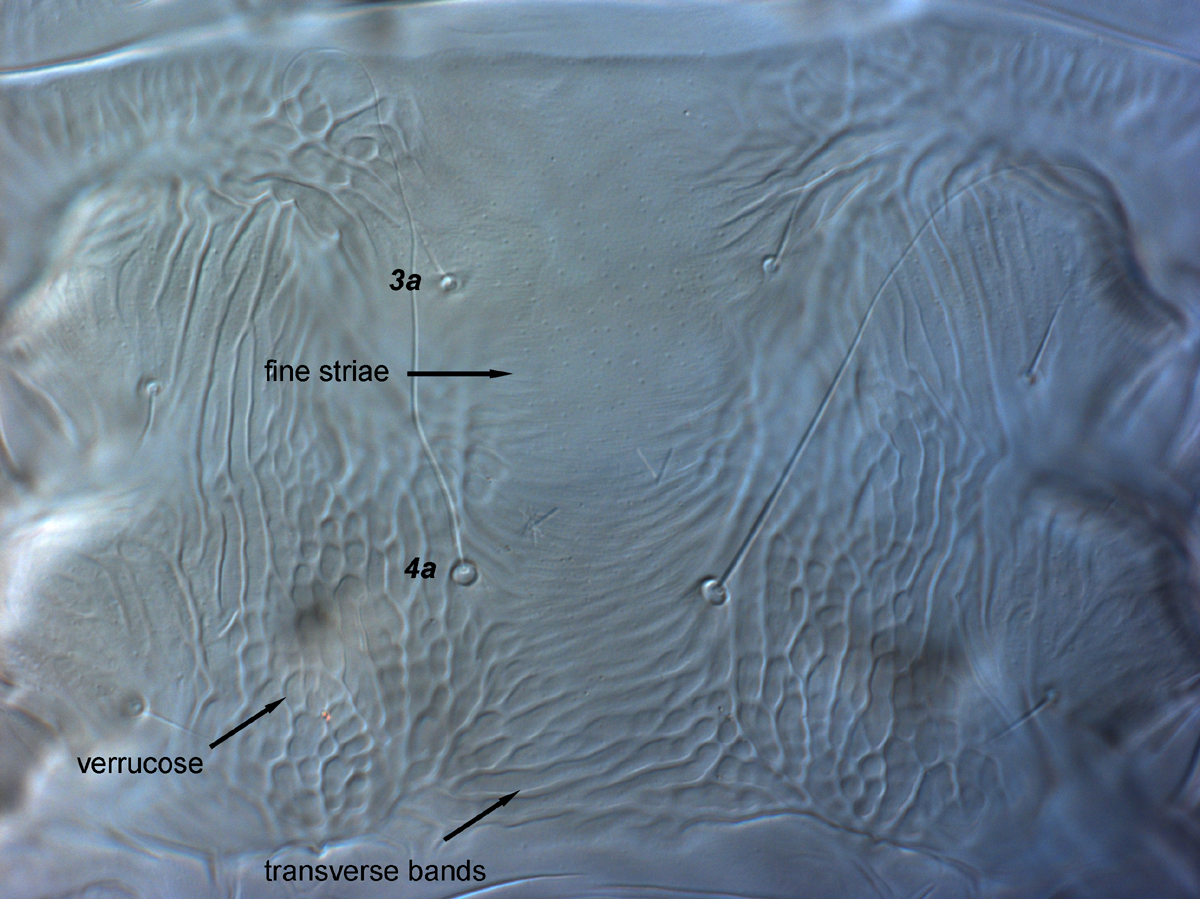  Fig. 11.  Brevipalpus feresi , female venter, between coxae III-IV. 