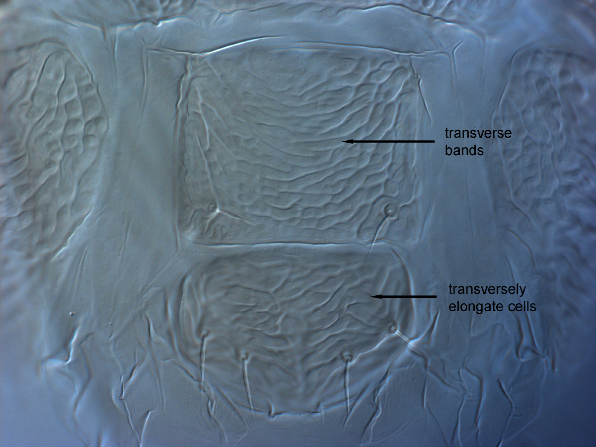  Fig. 14.  Brevipalpus feresi , female posterior venter. 