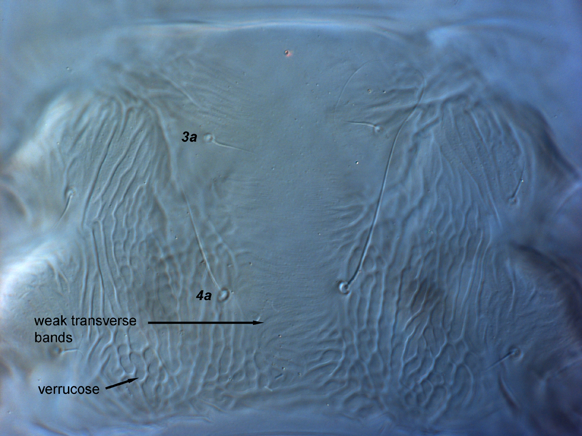  Fig. 12.  Brevipalpus feresi , female venter, between coxae III-IV. 