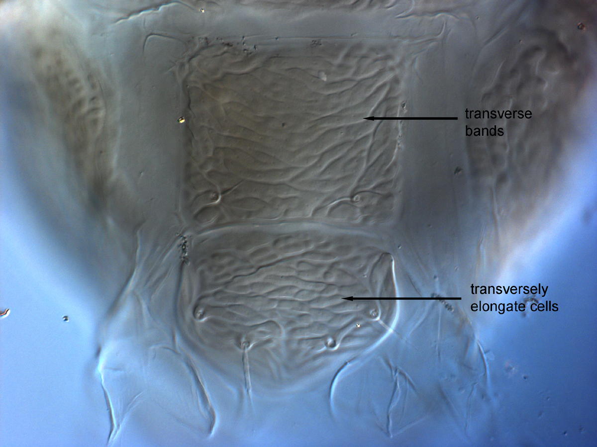  Fig. 15.  Brevipalpus feresi , female posterior venter. 