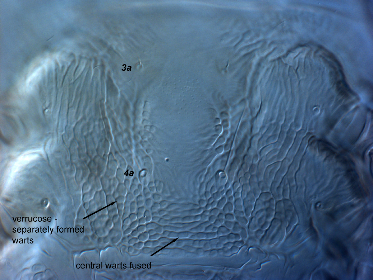  Fig. 13.  Brevipalpus feresi , female venter, between coxae III-IV. 