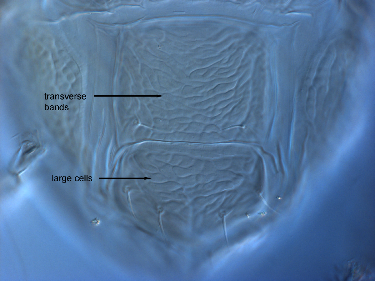  Fig. 17.  Brevipalpus feresi , female posterior venter. 