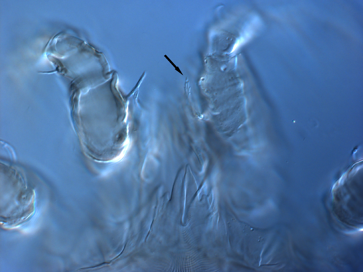  Fig. 10.  Brevipalpus feresi , female dorsal seta on palp (indicated by arrow). 