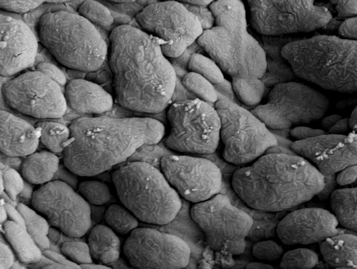  Fig. 9.  Brevipalpus feresi , female microplates on dorsal cuticle (15,000 X) (Image taken by G. Bauchan, USDA-ECMU). 