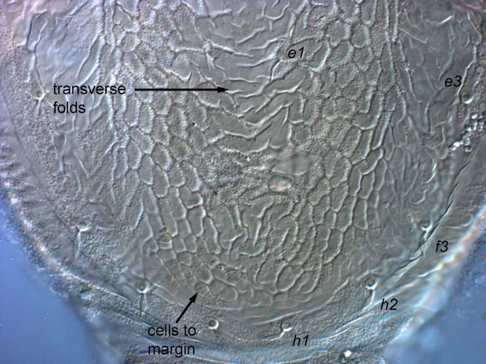            Fig. 10.   Brevipalpus obovatus  female posterior   dorsum.   