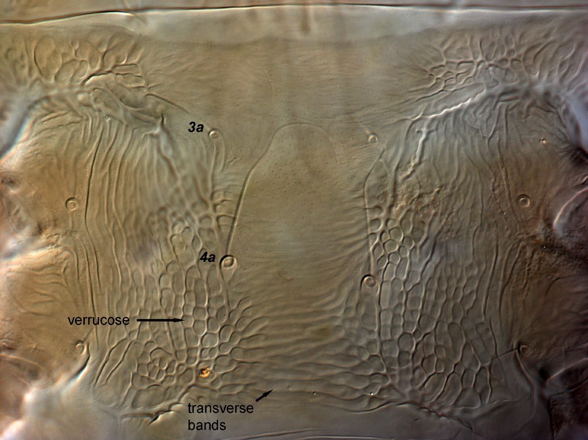  Fig. 11.  Brevipalpus papayensis , female venter, between coxae III-IV (paratype). 