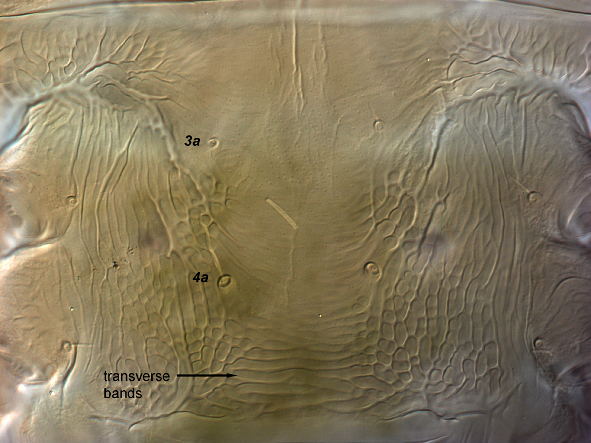  Fig. 12.  Brevipalpus papayensis , female venter, between coxae III-IV (paratype). 