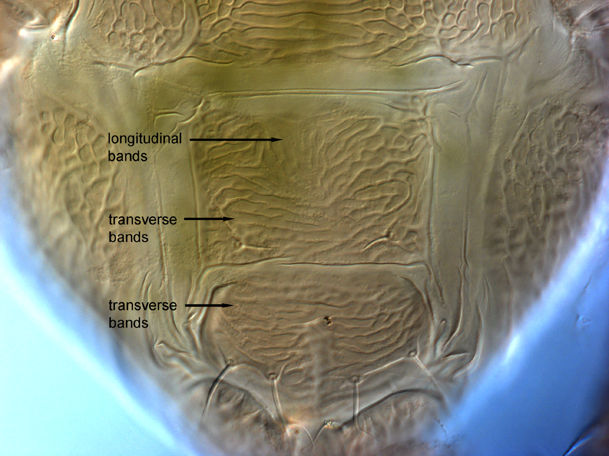  Fig. 14.  Brevipalpus papayensis , female posterior venter (paratype). 