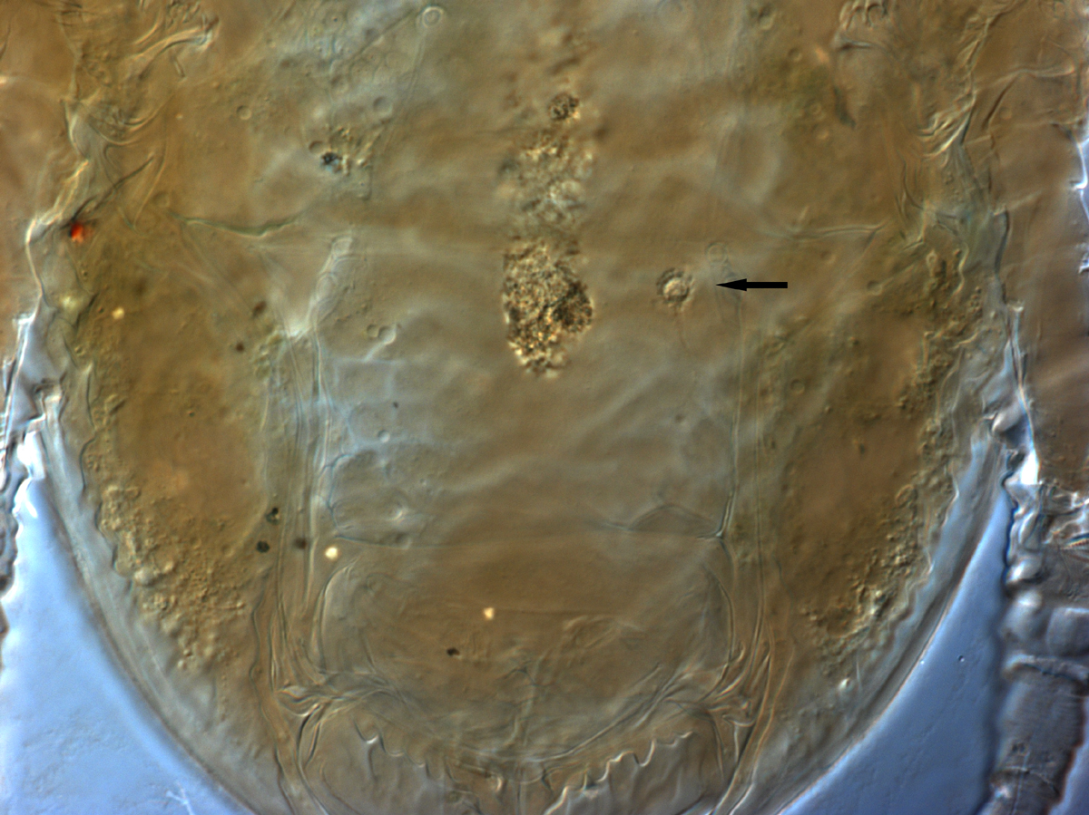  Fig. 16.  Brevipalpus papayensis , female spermatheca (indicated by arrow) (paratype). 