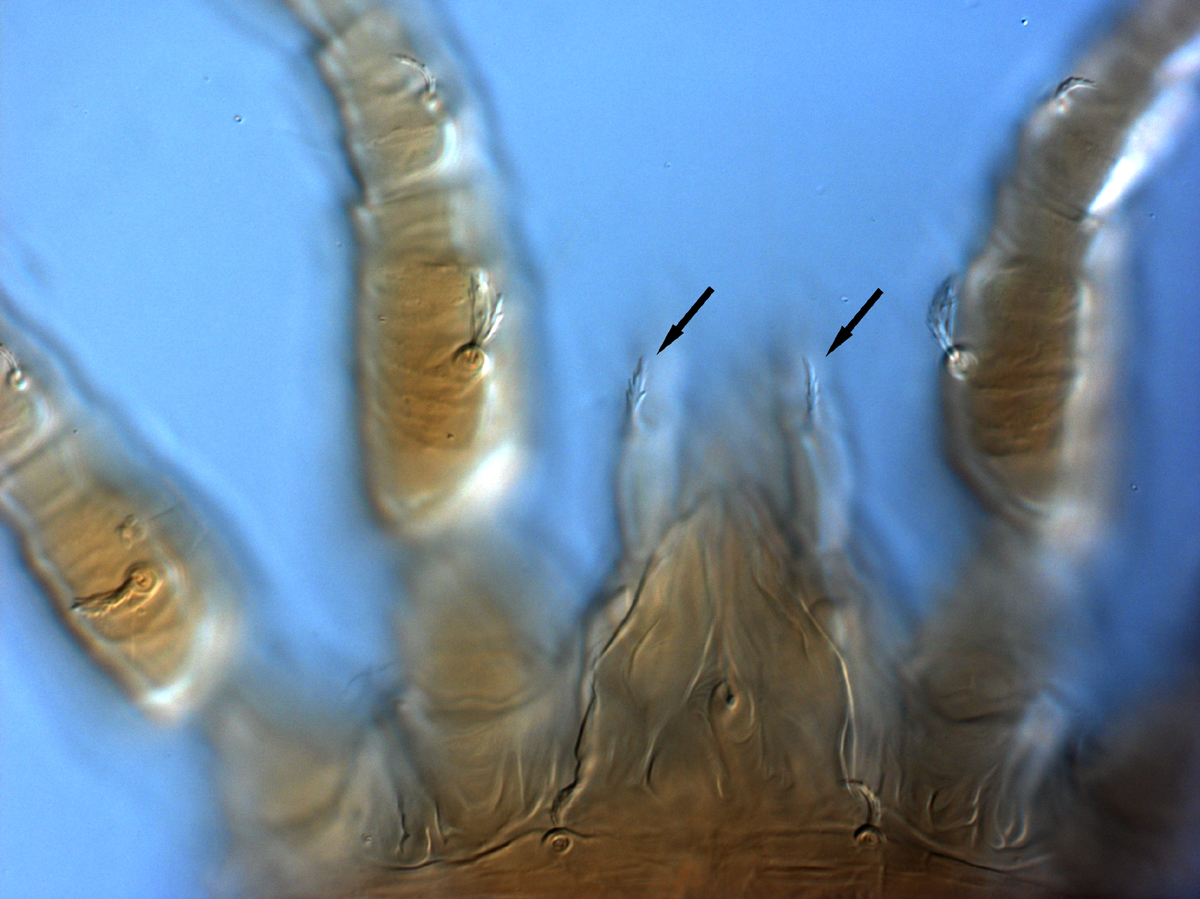 Fig. 10.  Brevipalpus papayensis , female dorsal seta on palp (indicated by arrows) (paratype). 