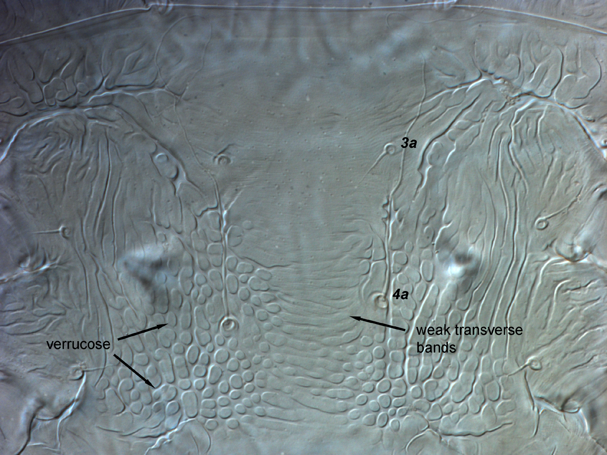  Fig. 11.  Brevipalpus azores , female venter, between coxae III-IV. 