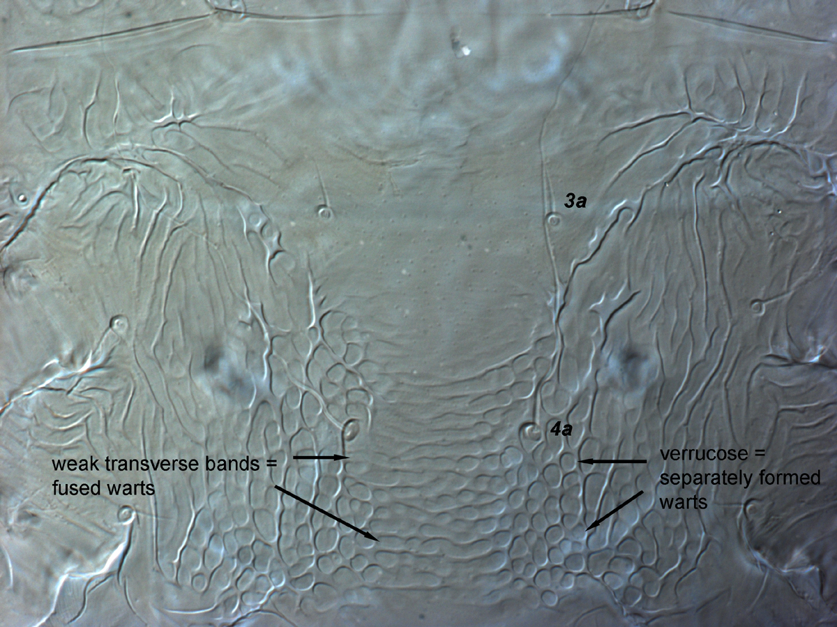  Fig. 10.  Brevipalpus azores , female venter, between coxae III-IV. 