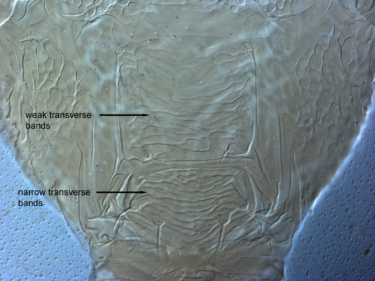  Fig. 12.  Brevipalpus azores , female posterior venter. 