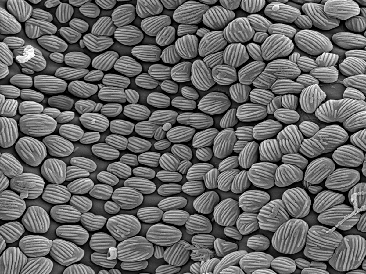  Fig. 10.  Brevipalpus yothersi , adult female microplates on dorsal cuticle (15,000 X). 