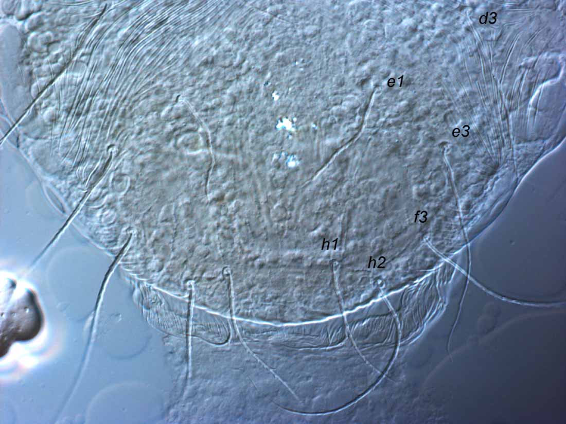            Fig. 4.   Capedulia prasadi  adult female   posterior dorsum.   